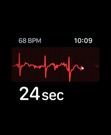 ECG app, beats per minute in top left corner, rhythm line, timer